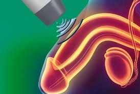 ESWT ve PRP Tedavisi