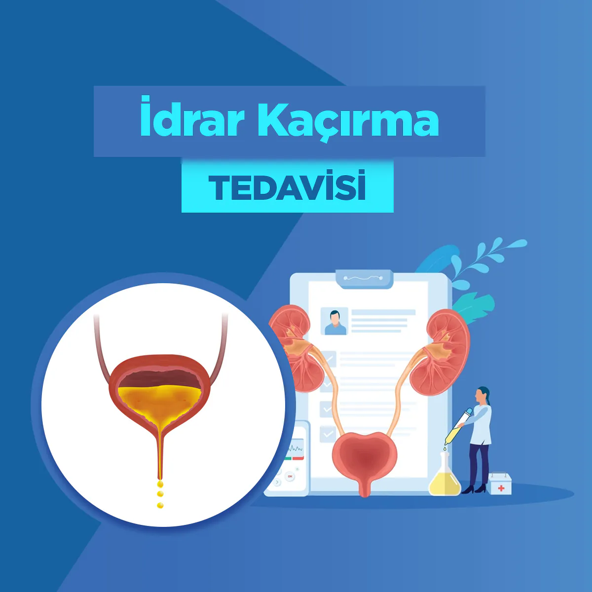 İdrar Kaçırma ve ESWT