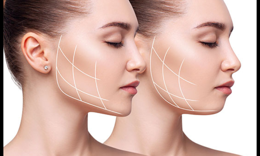 Yüz ve Çene Mezoterapisi